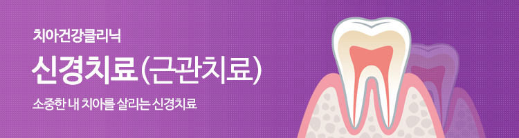 소중한 내 치아를 살리는 신경치료(근관치료) 이미지