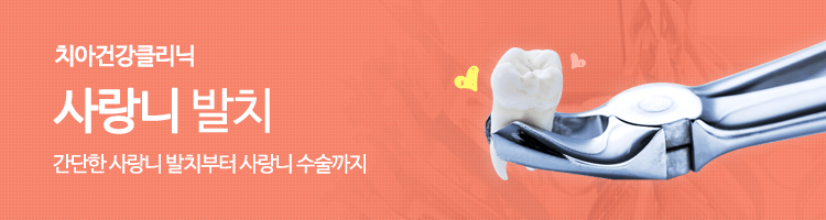 충치치료 이미지
