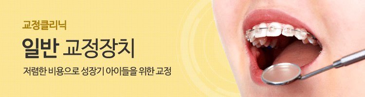 저렴한 비용으로 성장기 아이들을 위한 교정, 일반교정장치